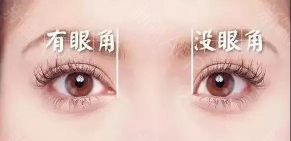 新乡开眼角