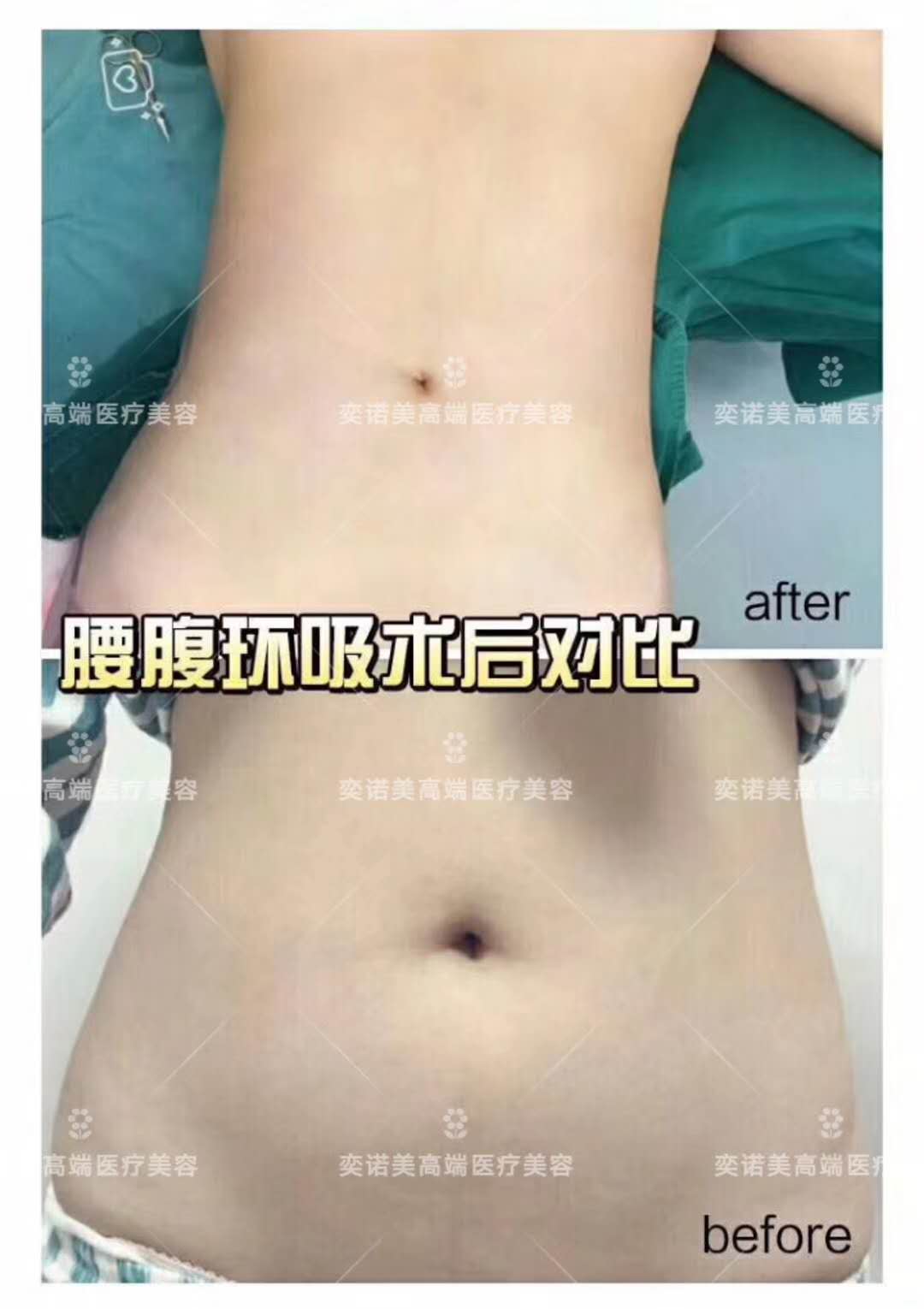 新乡奕诺美