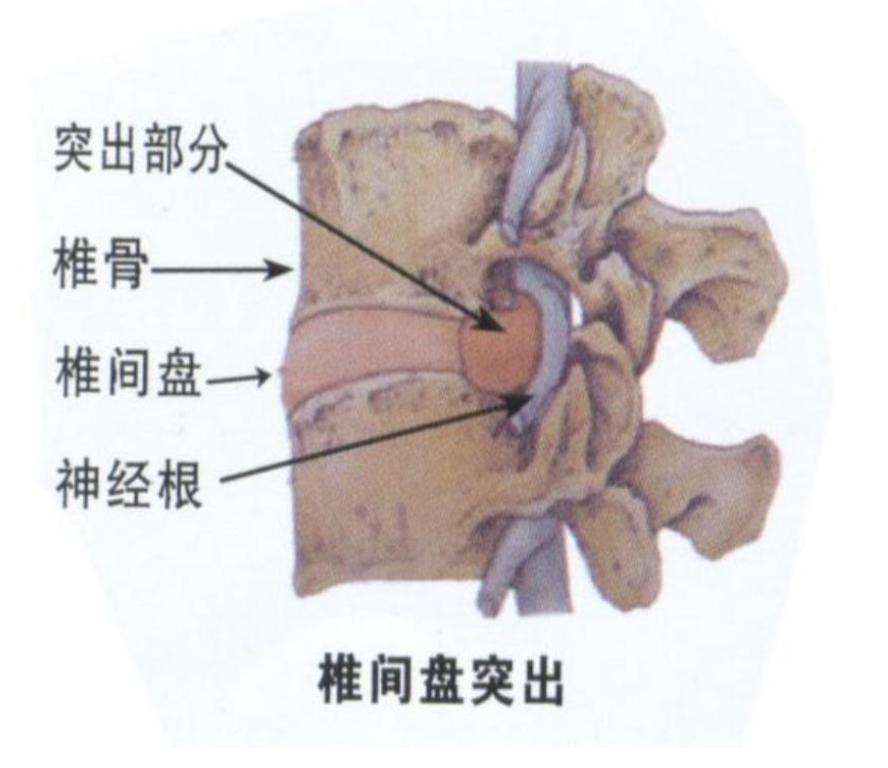 健骼宁