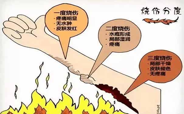 盘锦烧烫伤治疗