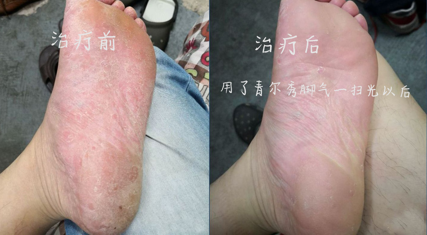 唐山膏药贴制造商