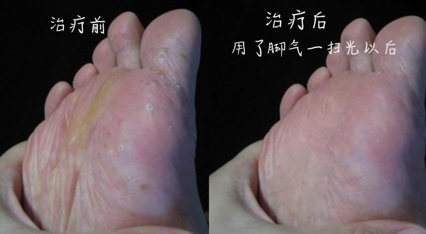 唐山膏药贴制造商