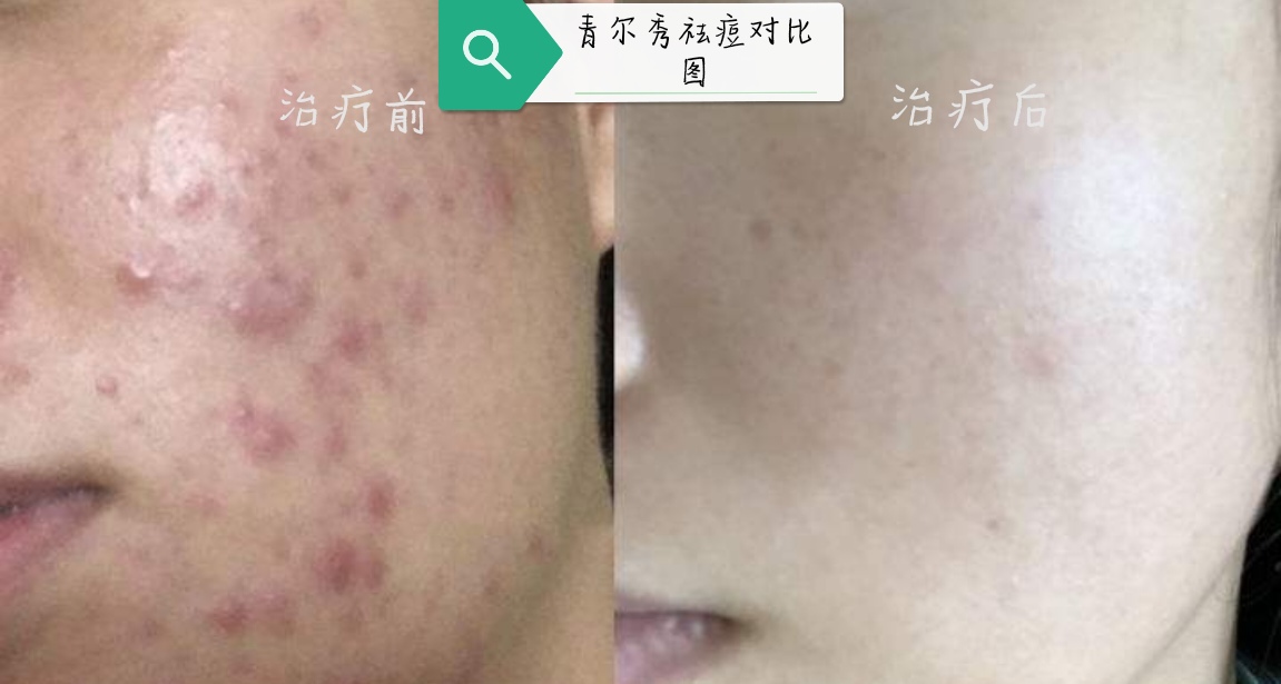 唐山膏药贴制造商