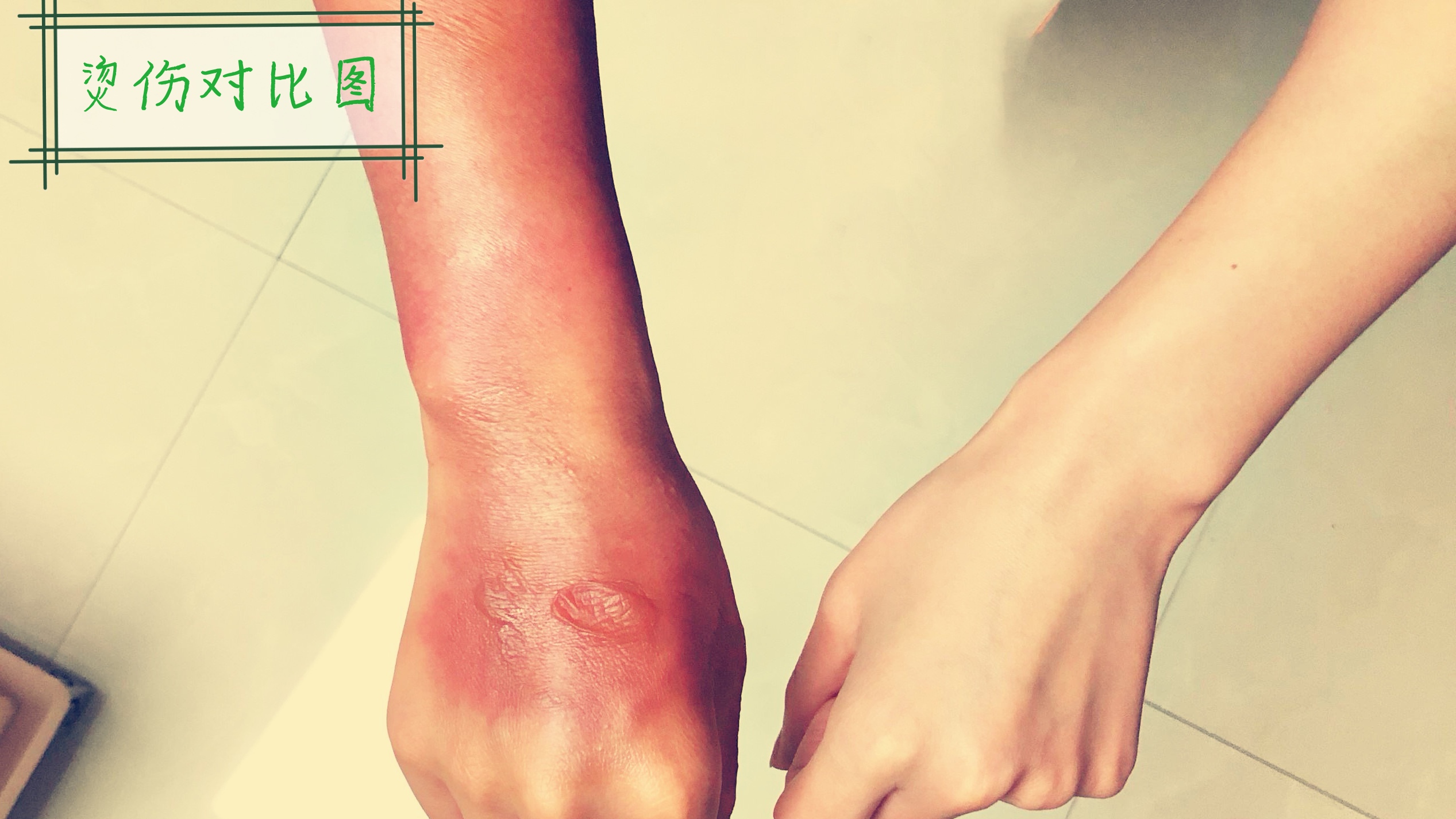 唐山膏药贴制造商