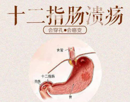 消化道胃