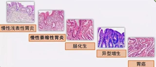 消化道胃