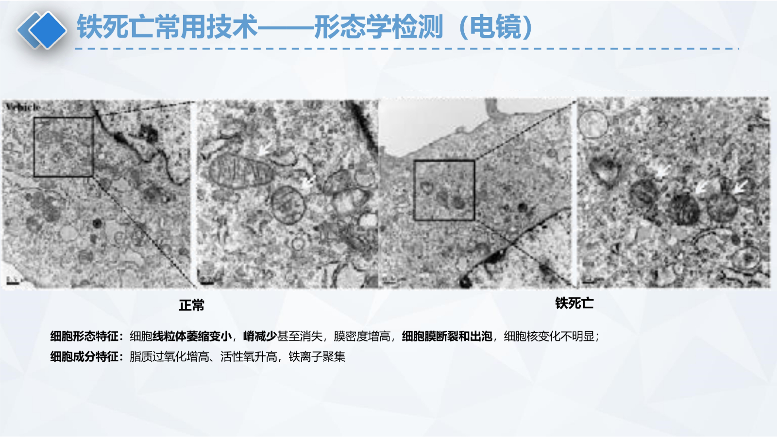 铁死亡