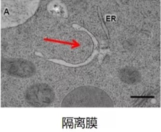 细胞自噬