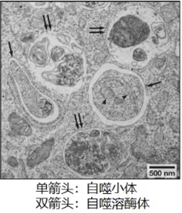 细胞自噬