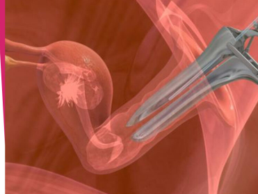 试管婴儿 （IVF） 中移植了多少个胚胎？