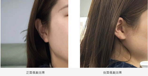为什么越来越多的人选择RIC助听器？