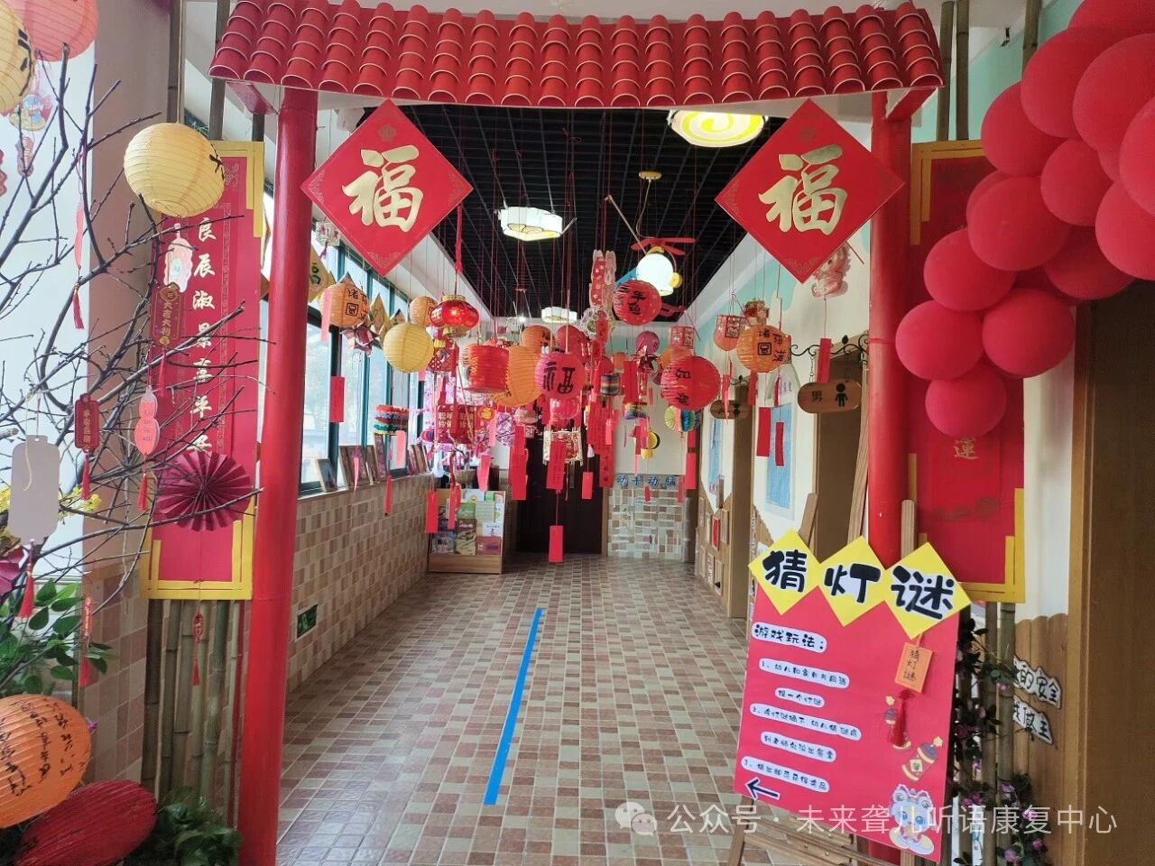 人工耳蜗
