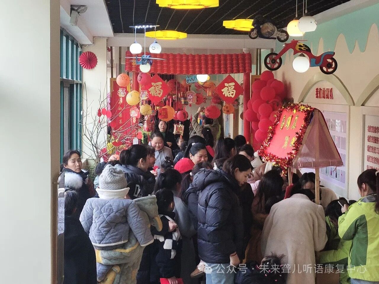 人工耳蜗