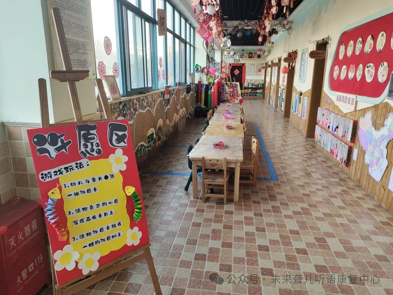 人工耳蜗