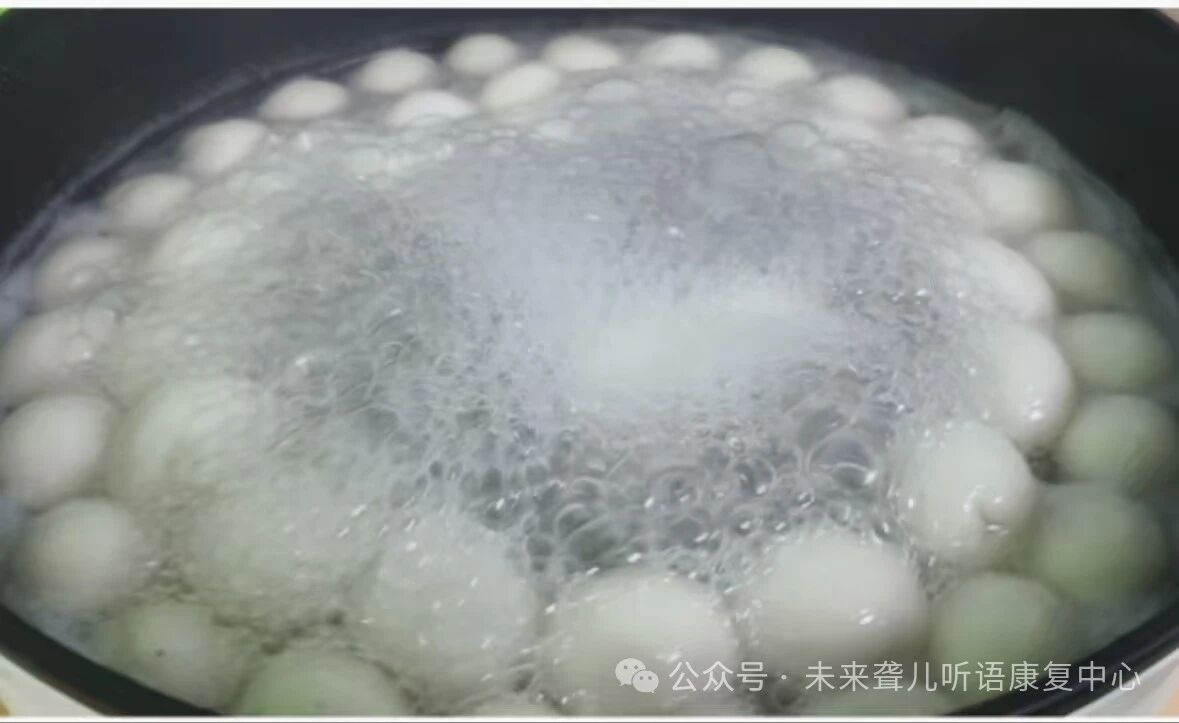 人工耳蜗