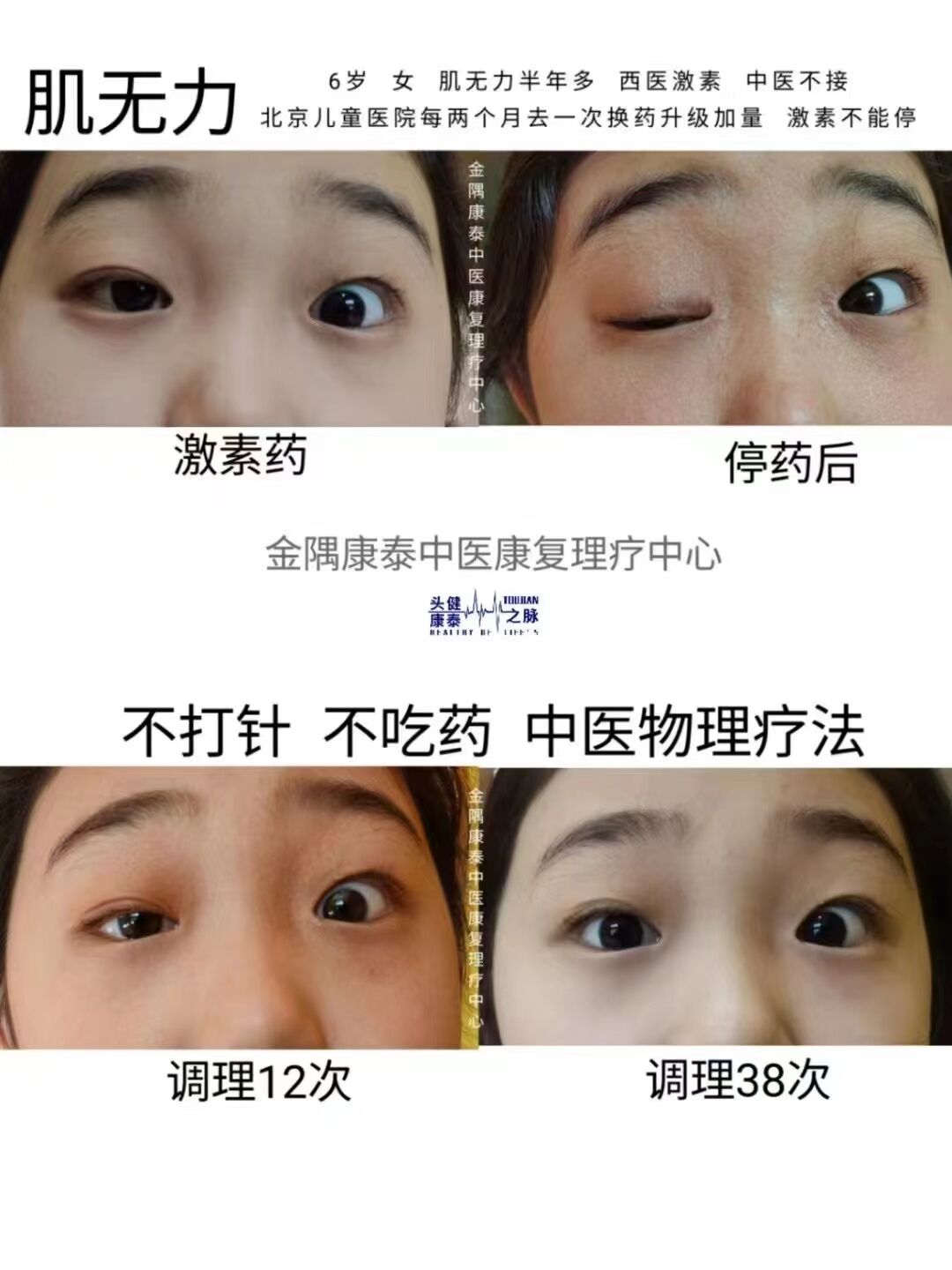 母婴