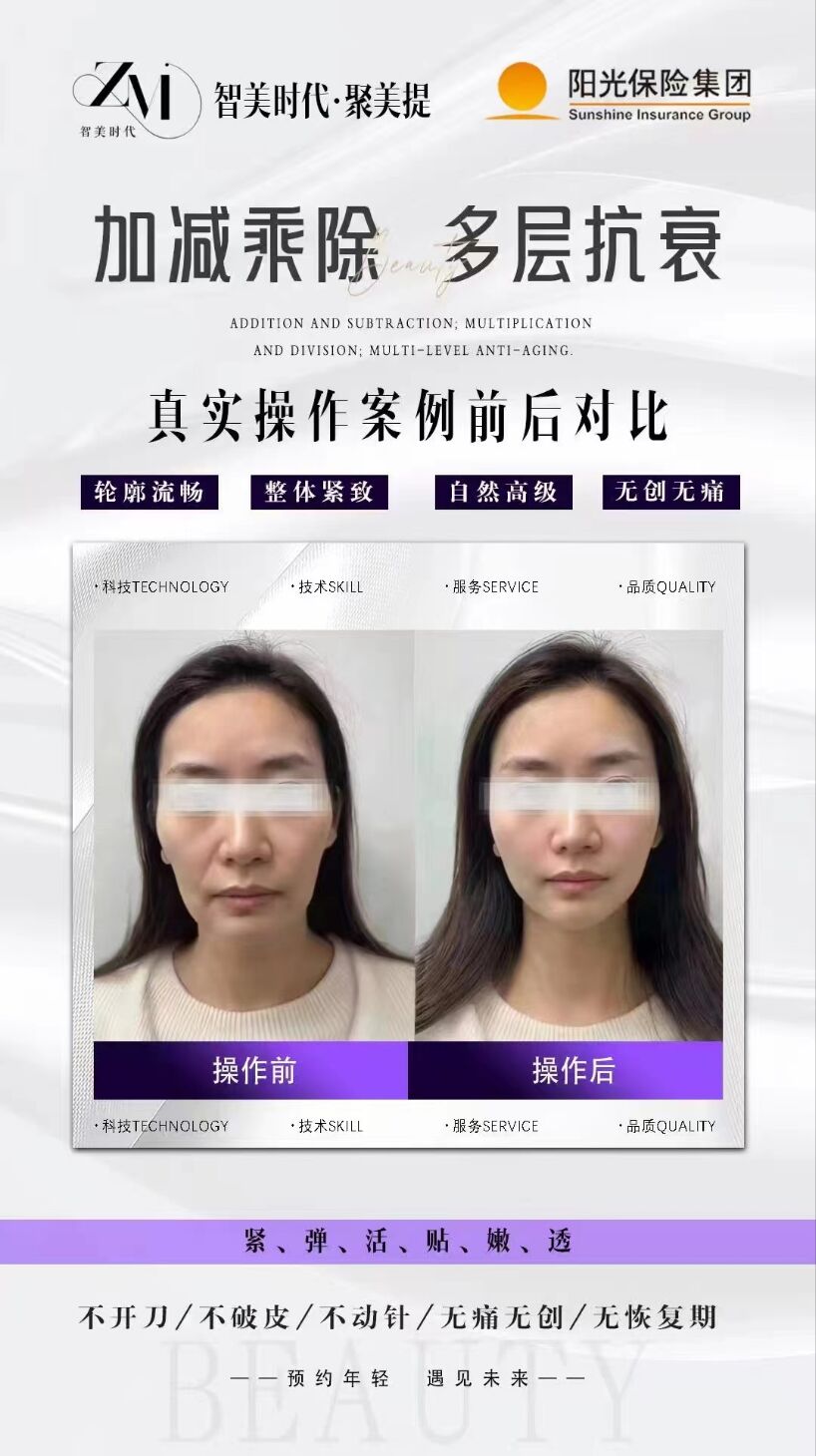 母婴