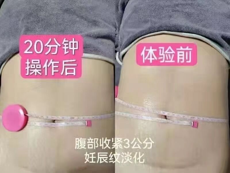 母婴
