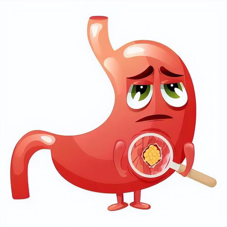 1765249781981389.jpg 胃癌