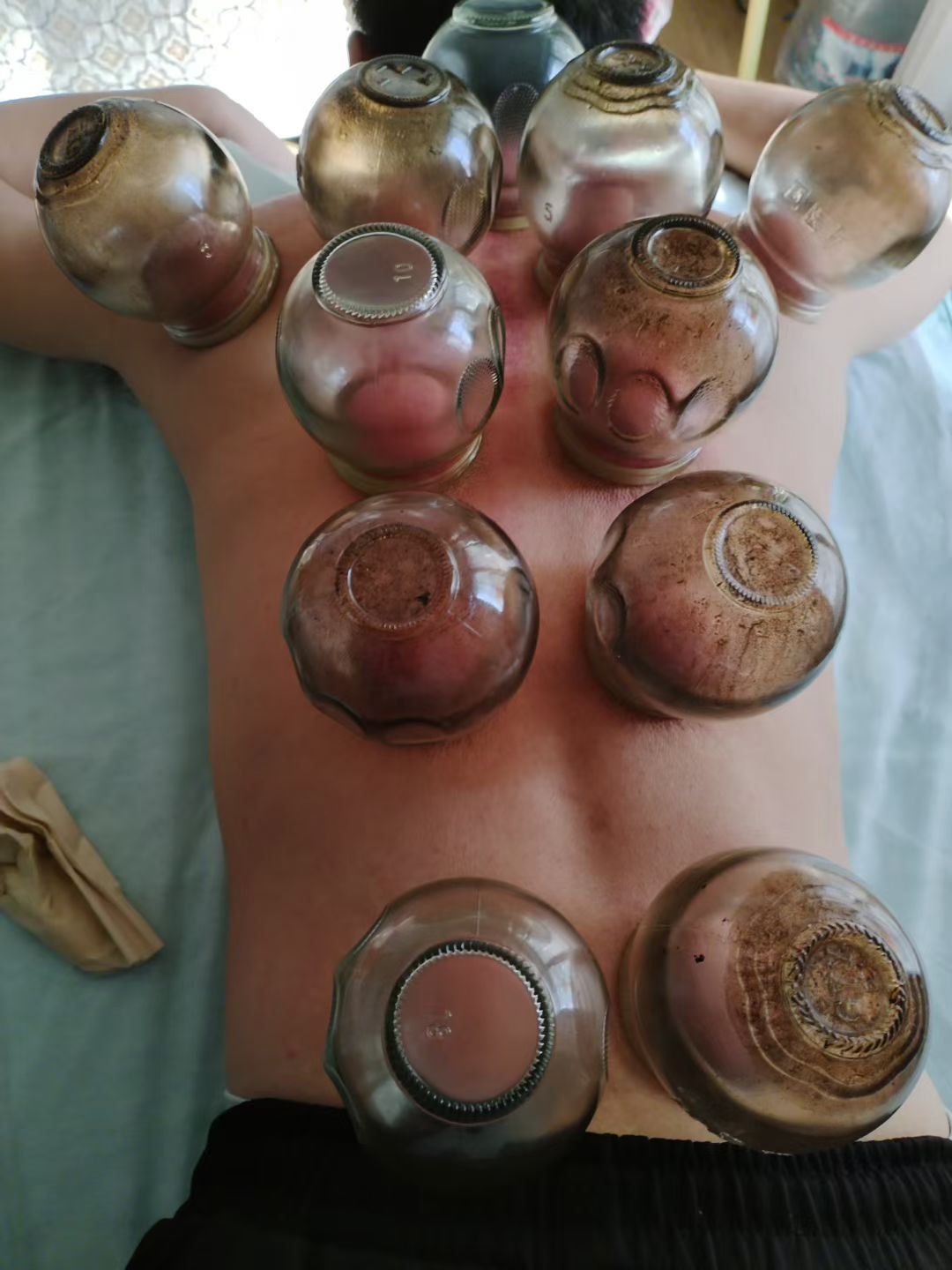 推拿