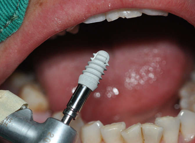 ha图层植体特性